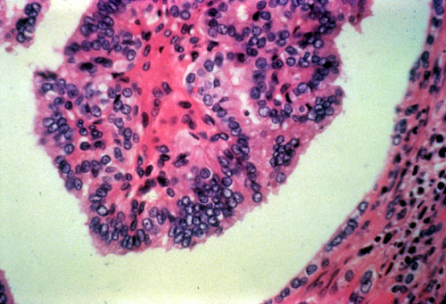 Pathology Teaching Slide Endocrine Pathology